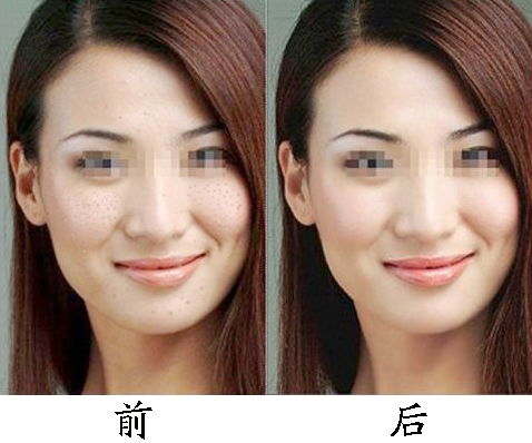 怎样有效去除抬头纹？6个消除额头纹的方法 3