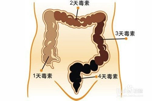 问答揭秘：如何高效清除肠道宿便，打造轻盈体态？ 2