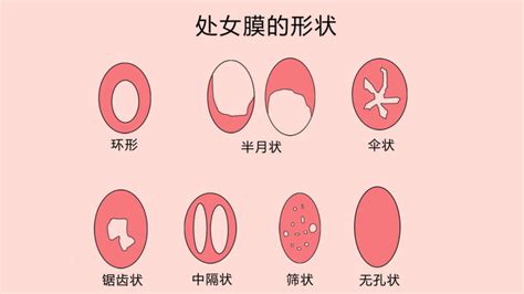 揭秘：处女膜的神秘功能与意义 1