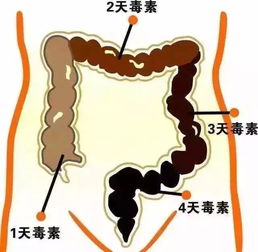 问答揭秘：如何高效清除肠道宿便，打造轻盈体态？ 3