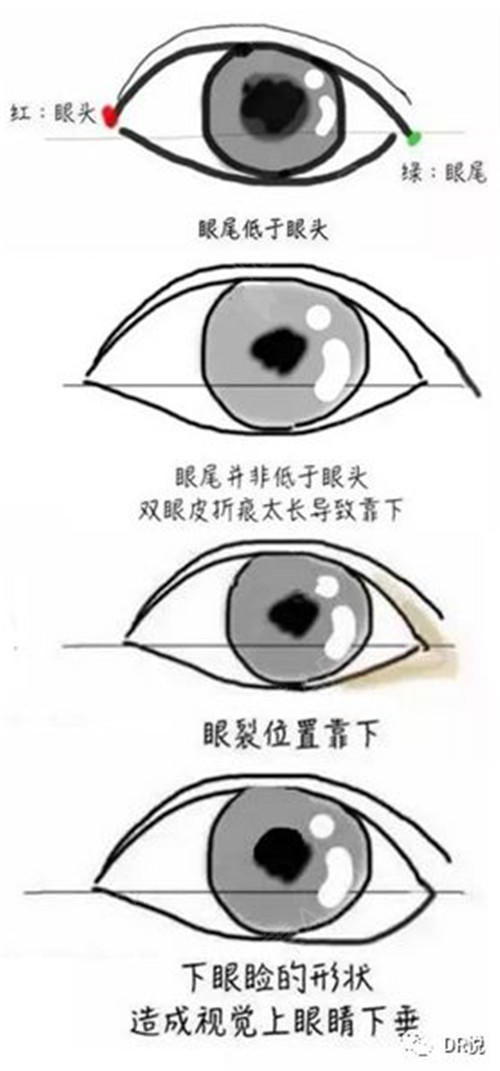 眼睛类型详细图解指南 3