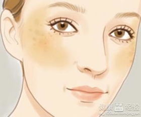 有效去除黄褐斑的绝妙方法 1