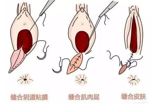 Breast, Bosom, Chest：三者之间的区别是什么 2