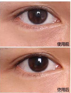 有效消除眼角细纹的方法 4