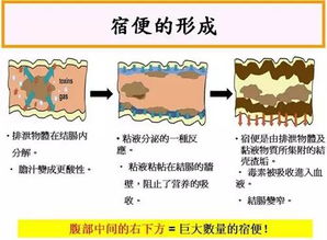 问答揭秘：如何高效清除肠道宿便，打造轻盈体态？ 4